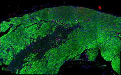 Infarcted heart shows increased B2M expression