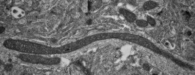 Parkinson's Disease Mitochondria
