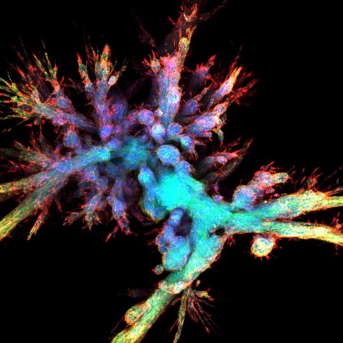 Pancreatic tumor organoid