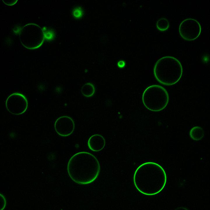 Protein-RNA vesicles (fluorescence microscopy)