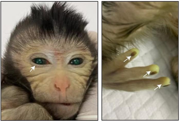 Images showing the green fluorescence signals in different body parts of the live-birth chimeric monkey at the age of 3 days