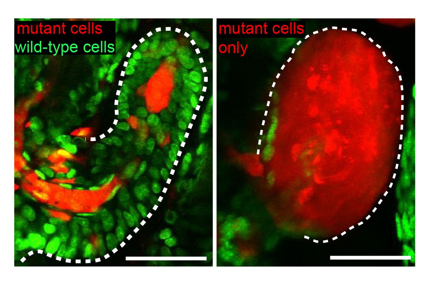 Neighbor Cells Help Police Cancer Tumors