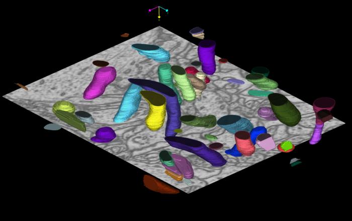 Image showing the automatic segmentation of mitochondria – the “powerhouses” of the cell – provided by the software model in an electron microscopy. Each mitochondrion is shown in an individual colour.