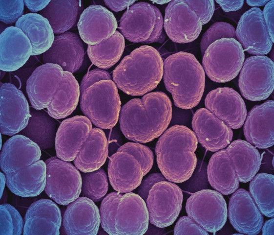 Neisseria Gonorrhoeae Bacteria, which Causes Gonorrhea