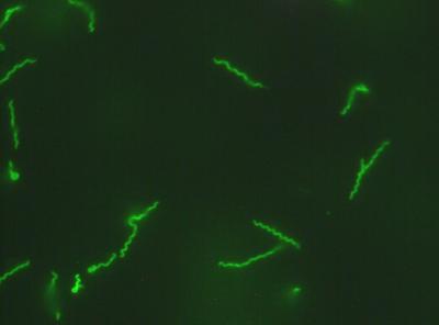 <I>Treponema denticola</I>