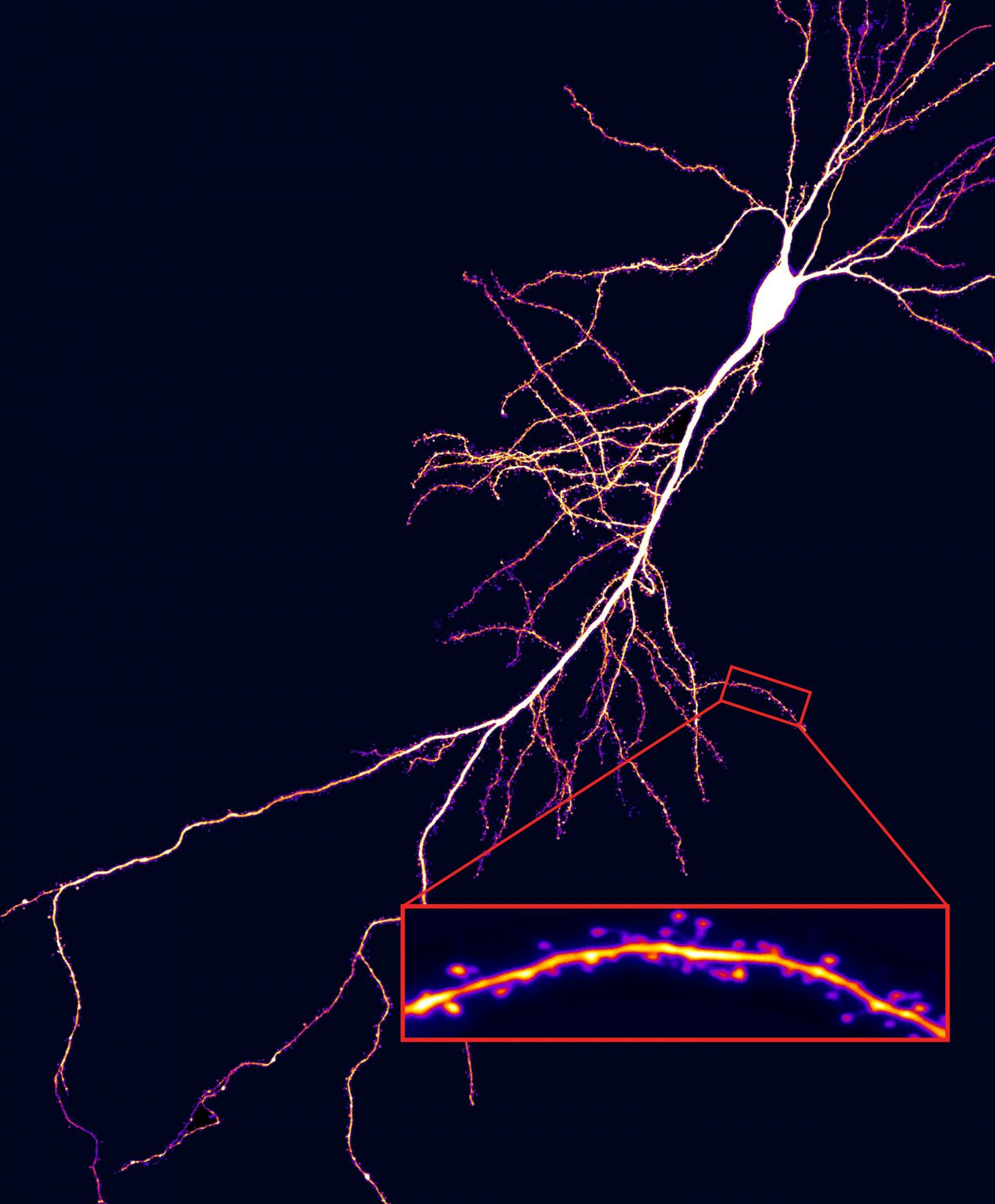 Dendritic Spinds are Visible on a Micrograph of a Hippocampal Neuron