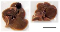 Adiponectin Inhibits Liver Cancer Development