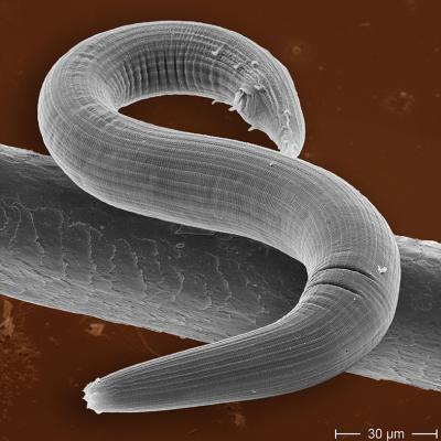 <i>Pristionchus maxplancki</i> Threadworm