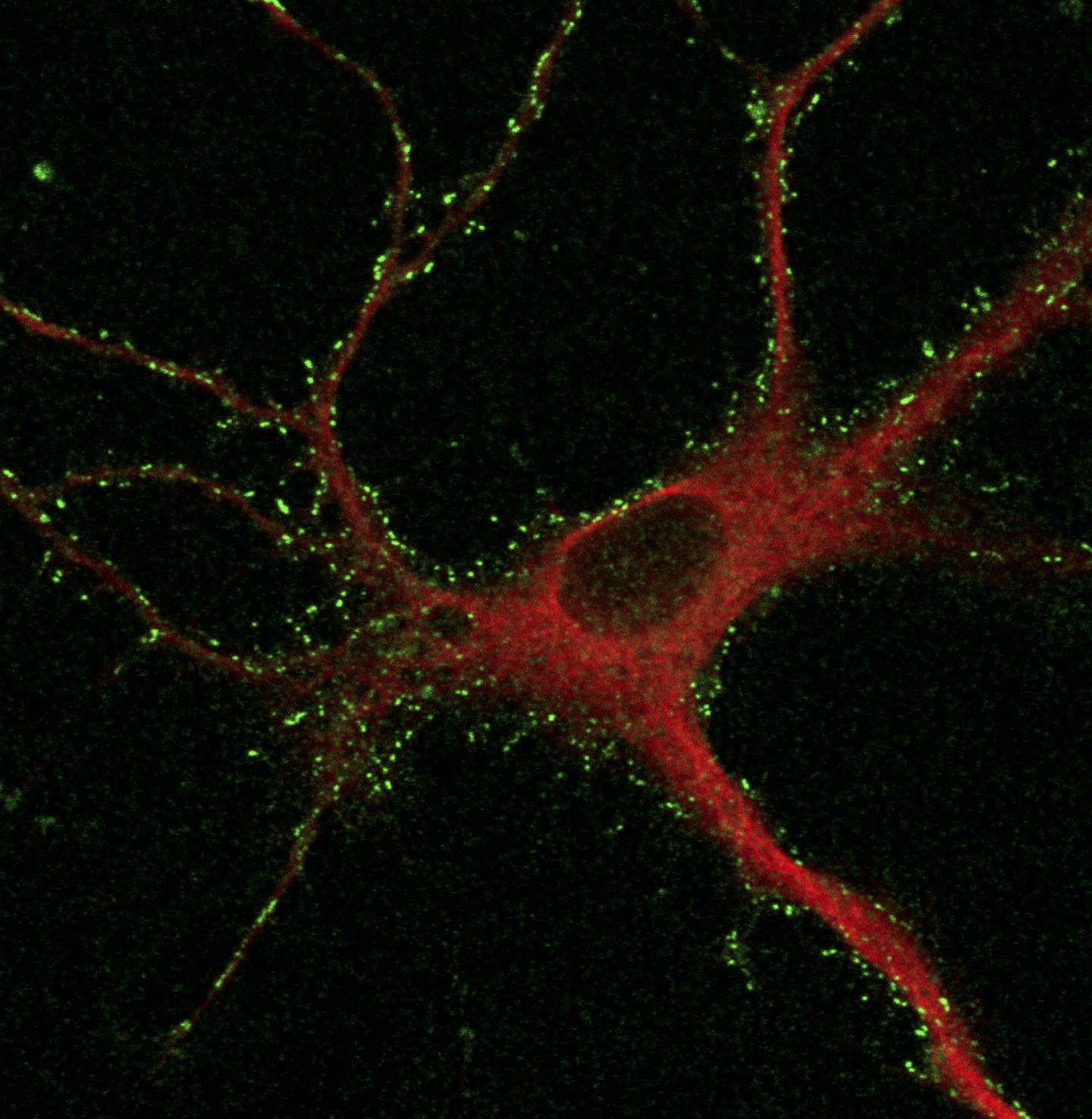 Cortical neurons after two-step labeling
