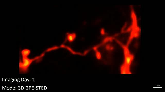 3D video of dendritic spines