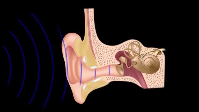 Towards an Understanding of Tinnitus Heterogeneity