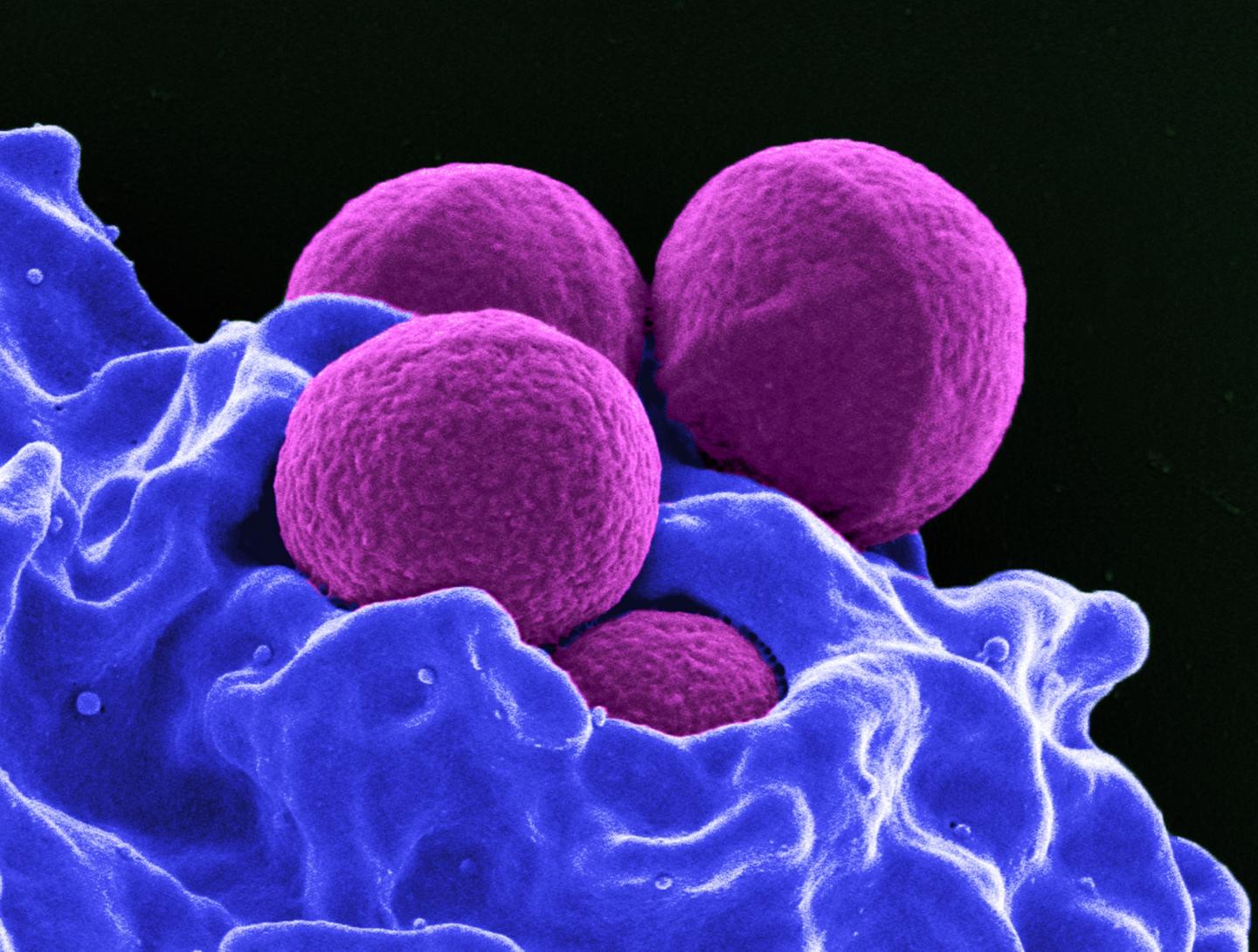 Staphyloccus Aureus