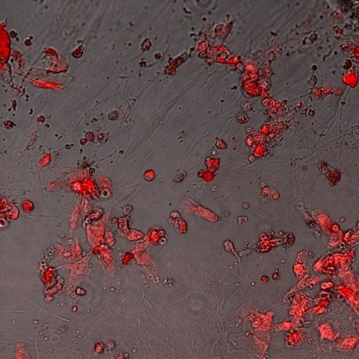 Fig. 1 The Accumulation of Lipid Degradation Products