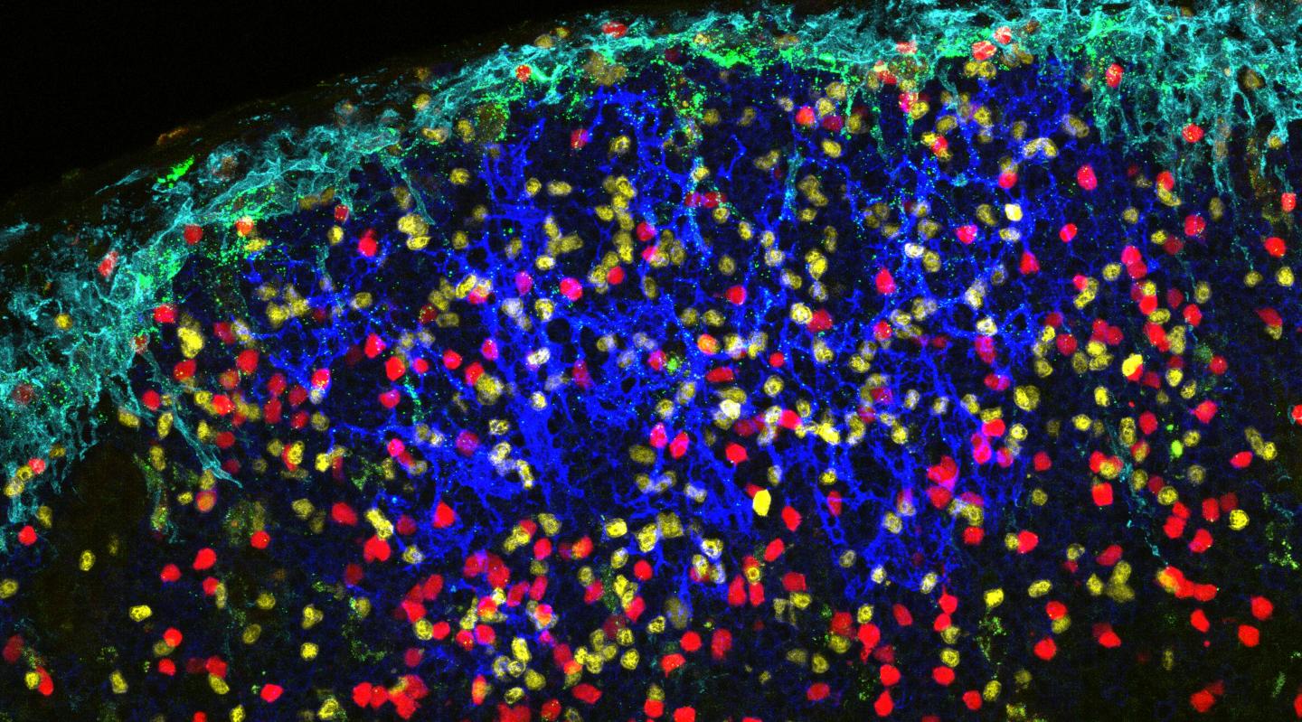 HIV-1 Virus-Like Particles in Lymph Node