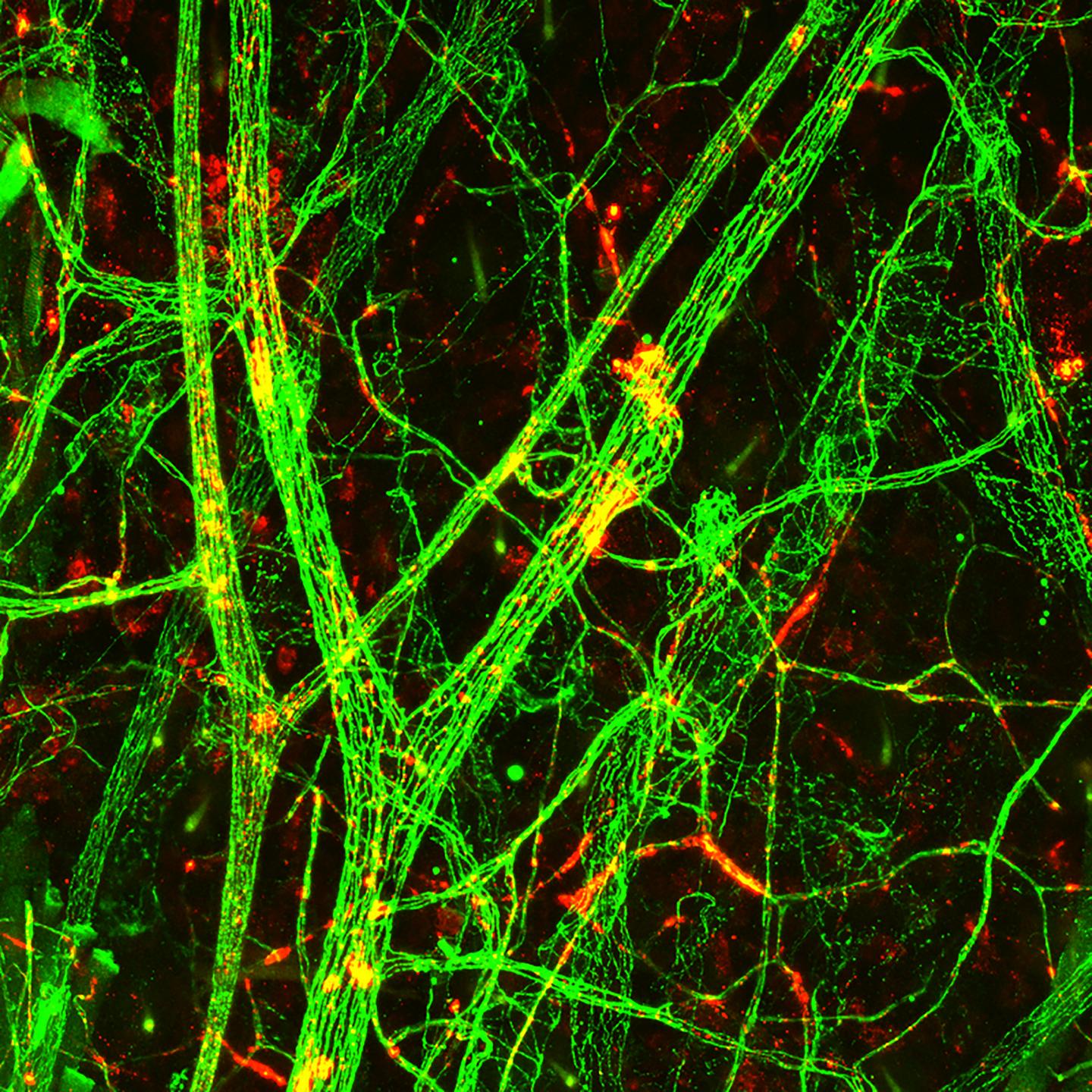 Scientists Found Means to Inhibit Capillary Leakage in Sepsis