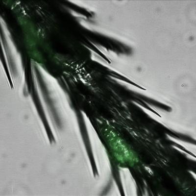 Fluorescent Yeast Cells Present on the Legs of Flies