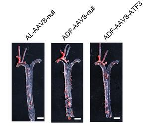 Hepatocyte-specific overexpression of ATF3 attenuates the effects of ADF on atherosclerotic plaque formation