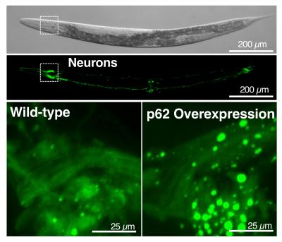 Surprisingly Large 'Recycling Plants,' or Vesicles