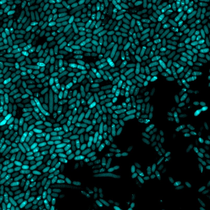 Vibrio bacteria expressing a structural component of the type 6 secretion system fused to a green fluorescent protein, therby allowing us to visualize the assembly of the secretion system using a fluorescence microscope.