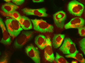 Effects of dialkynylcarbinols on HSD17B11-expressing cancer cells