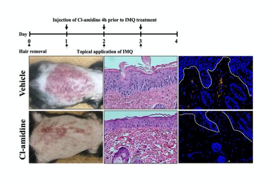 Decrease in psoriasis lesions