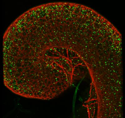 Lymphocytes (2 of 2)