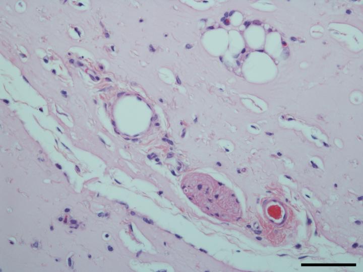 Mature Blood Vessels Formed in a Hydrogel