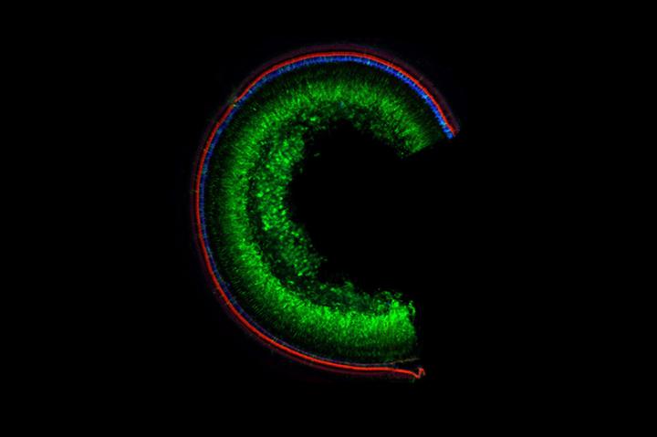 Mouse Cochlea Hearing Restored by Base Editing Technique