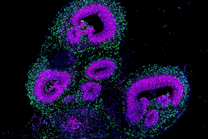 Brain organoid