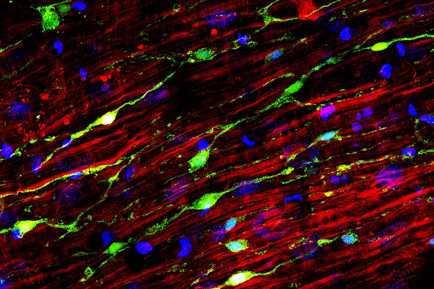Nerve Cells and Muscle Fibers in Hydra