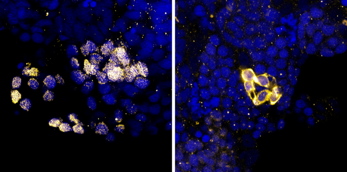 A NEW APPROACH TO BLOOM SYNDROME RESEARCH