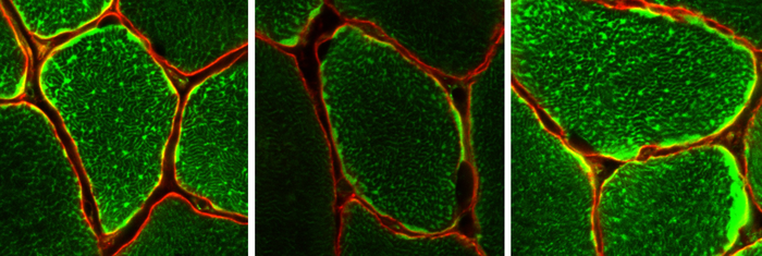 Staining showing mitochondria within individual muscle fibres.