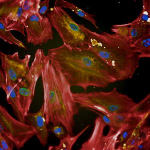 Astrocytes the beautiful stars of the central nervous system
