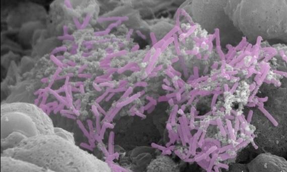 Lactobacillus crispatus [IMAGE] | EurekAlert! Science News Releases
