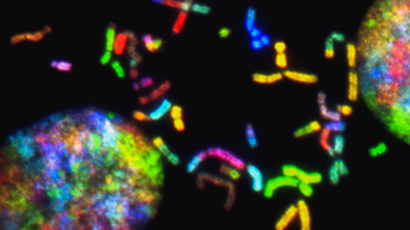 Brain cancer chromosomes