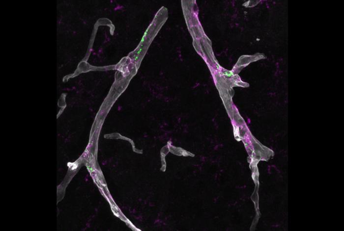 Immune cells in the brain called border-associated macrophages (green) are a source of ApoE4 (magenta) protein and contribute to damaging blood microvessels (gray) and brain tissue.