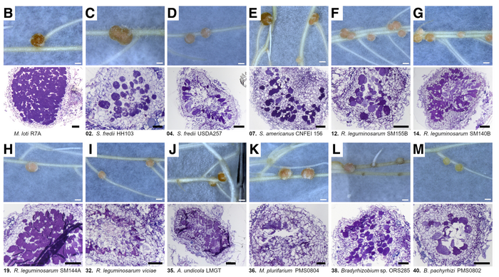 Nodule Histology Image Eurekalert Science News Releases