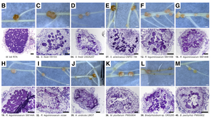 Nodule histology