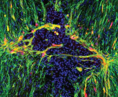 Astrocytes
