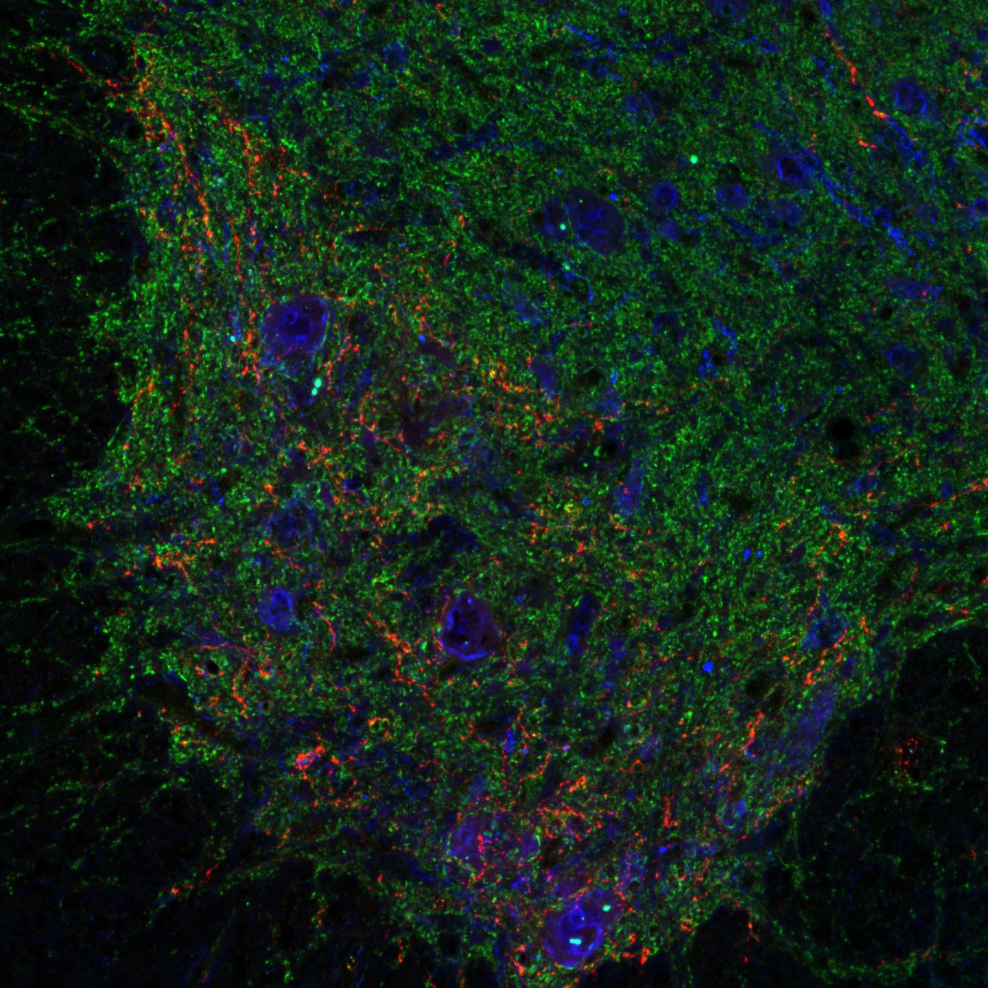 Cross-Section of a Rat's Spinal Cord Ventral Horn
