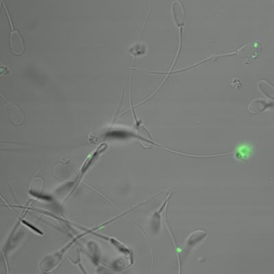 Boar Sperm Mixed with Nanoparticles that Have Been Tagged with Green Dye for Identification