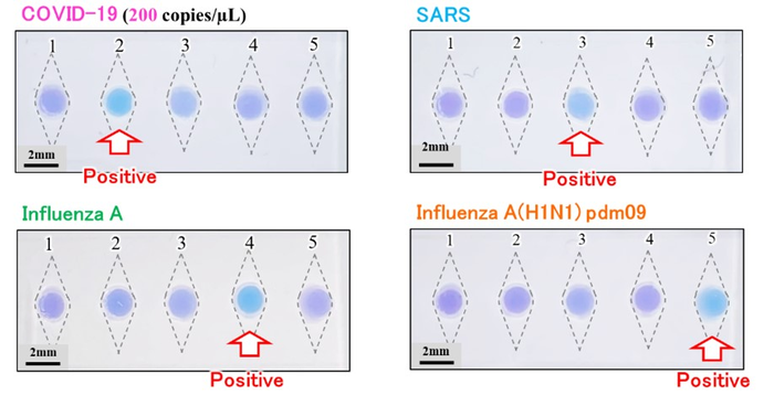 Results of multiplexed rapid diagnosis of infectious diseases