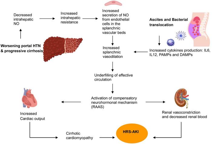 Pathophysiology of the hepatorenal syndrome acute kidney injury (HRS-AKI)