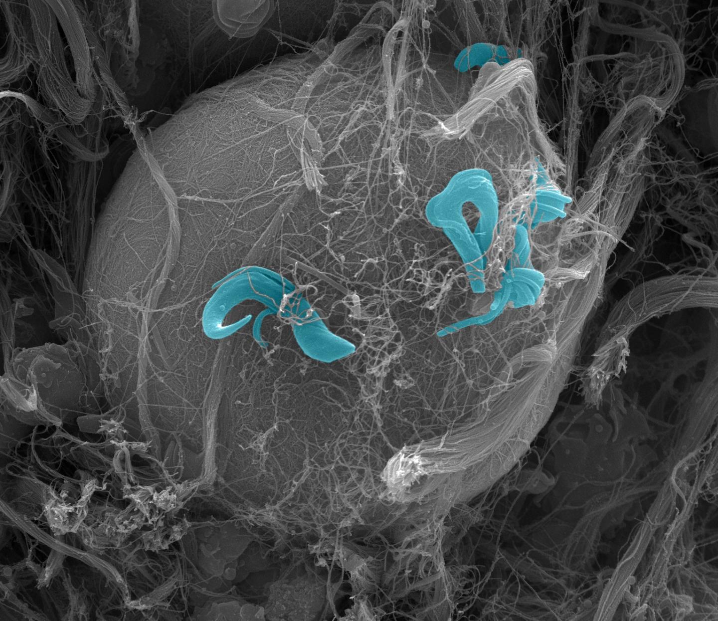 Following Tsetse Fly Bites, Fluorescent Parasites Reveal Trypanosome Invasion of the Skin and Beyond