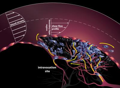 Early Stage of Metastasis