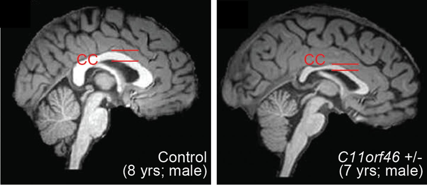 Healthy Human Brain