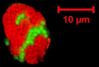 Consortia of <i>Archeae</i> and Bacteria