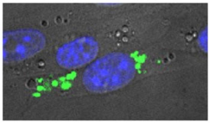 Intracellular P. gingivalis in human pancreatic cancel cells