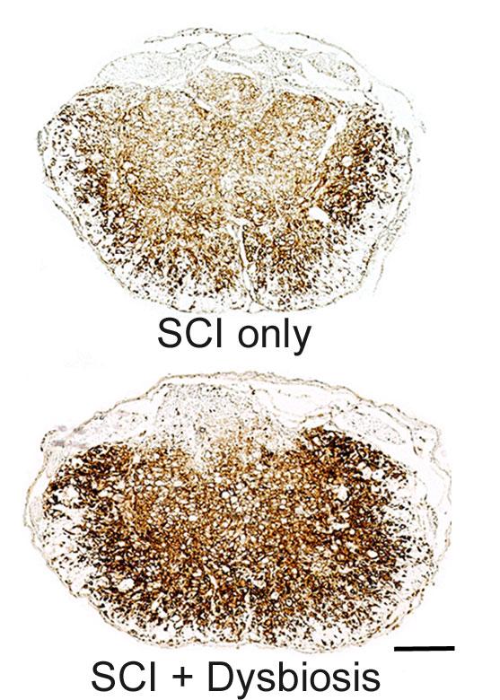 Dysbiosis Alters the Inflammatory Response to Spinal Cord Injury