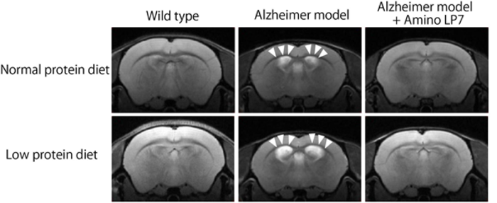 Brain magnetic resonance images showing the effects of Amino Lp7 and diet on brain atrophy